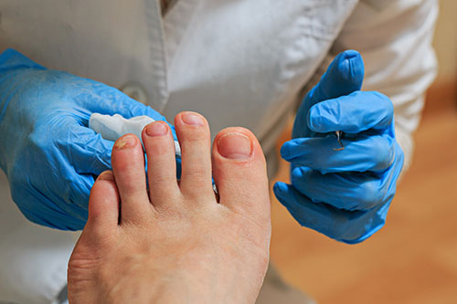 podiatrist conducting toe surgery